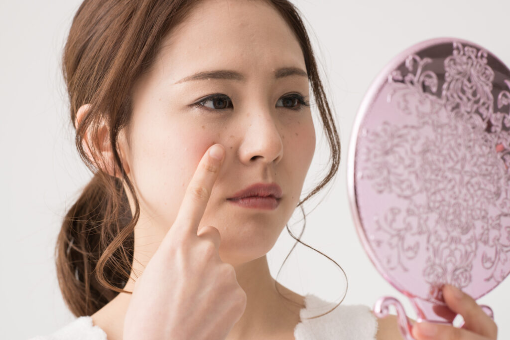 ほくろについて