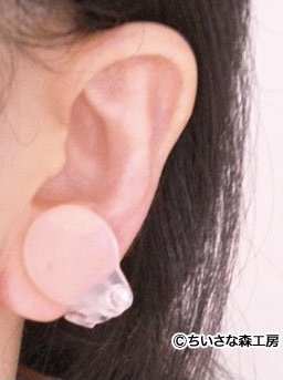 圧迫用イヤリング