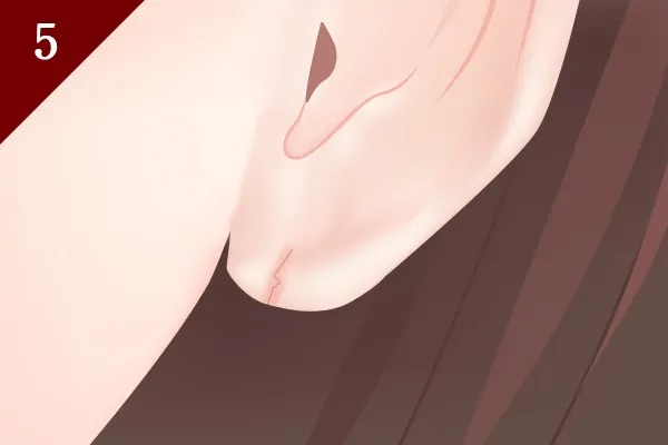 施術後・経過観察